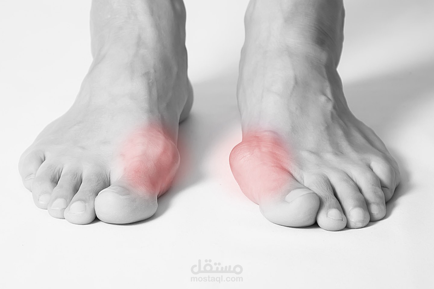 كتابة مقالات طبية: جراحة الإبهام الأفحج