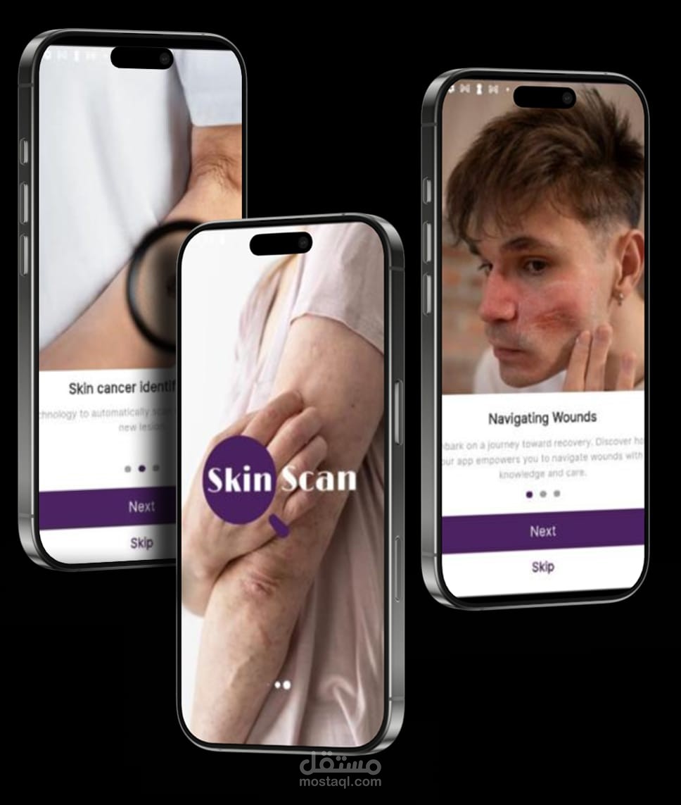 Skin Scan Disease