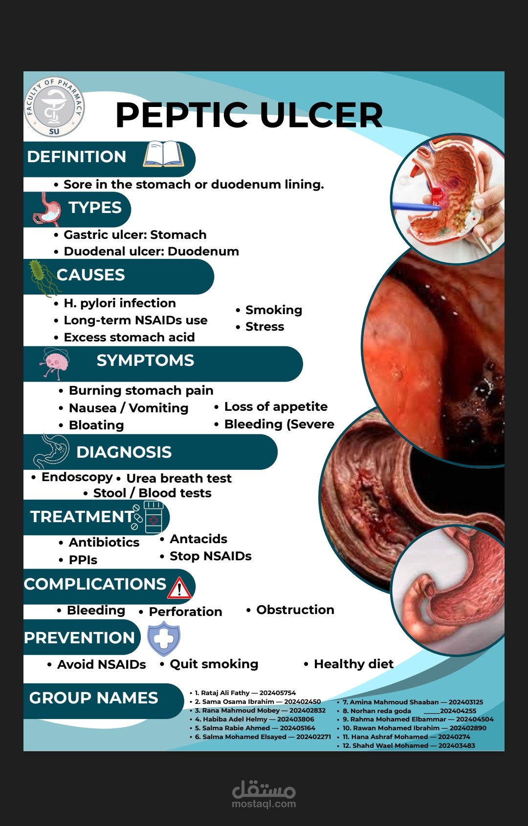 Comprehensive Guide to Peptic Ulcer Disease"