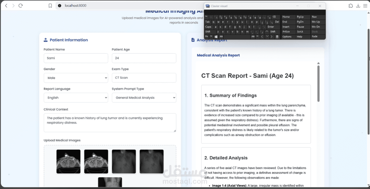 مشروع MedVision Doctor