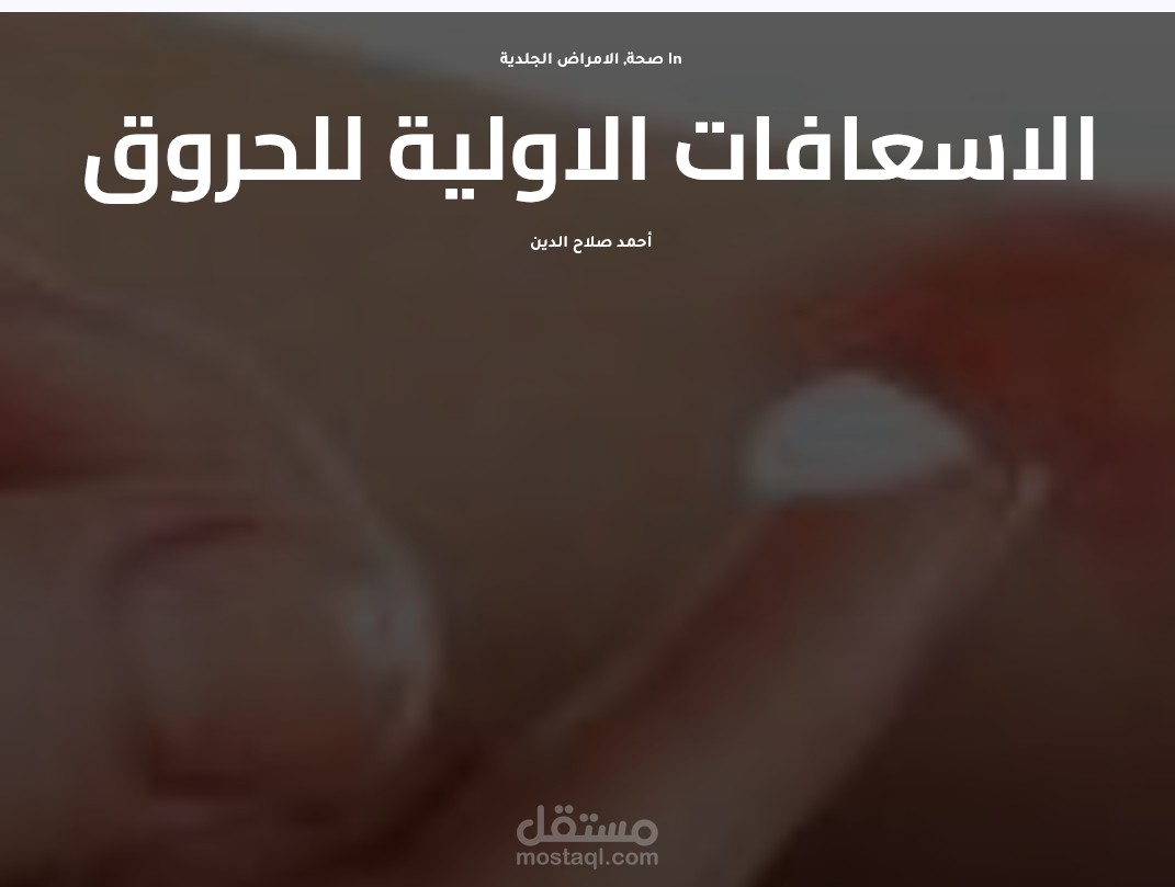 الإسعافات الأولية للحروق