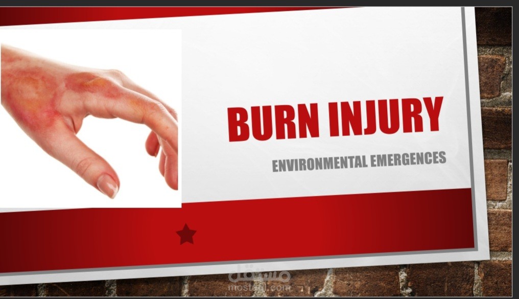 ملف بوربوينت عن الحروق