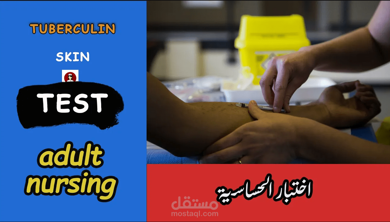 فيديو تمريضى عن كيفية عمل اختبار الحساسية