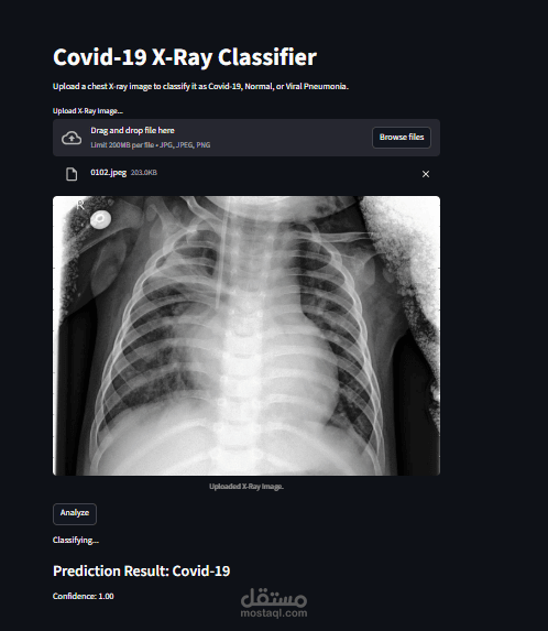 Covid-19 X-Ray Classification using CNN