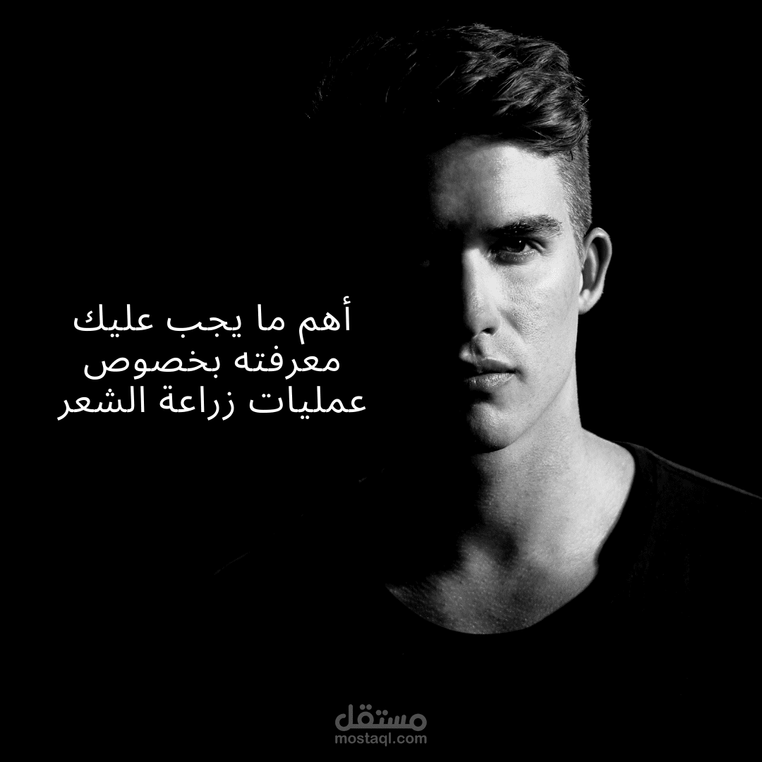 أهم ما يجب عليك معرفته بخصوص عمليات زراعة الشعر
