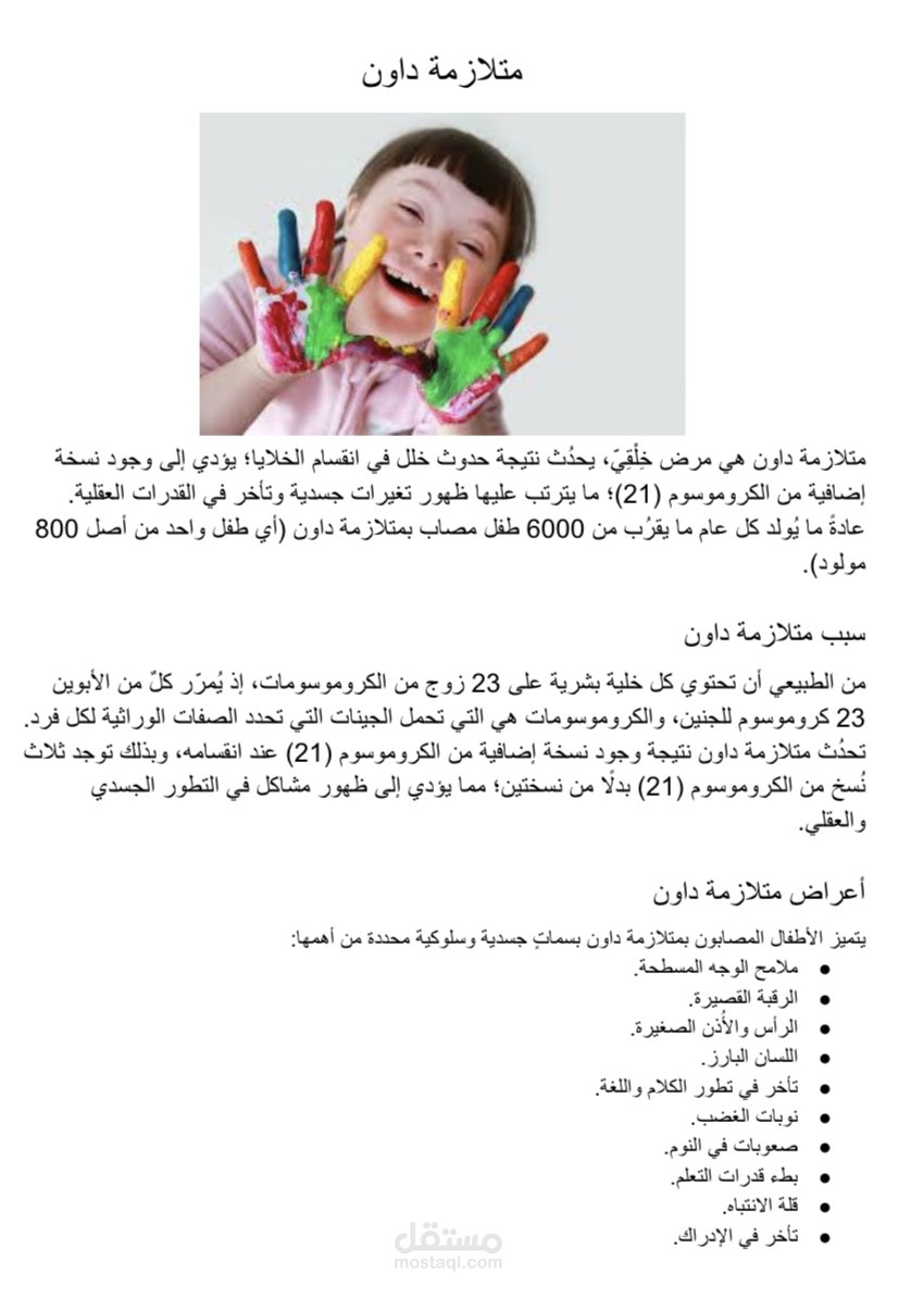 متلازمة داون