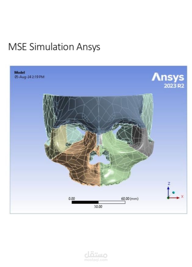 Maxillary skeleton expansion Modeling on ANSYS