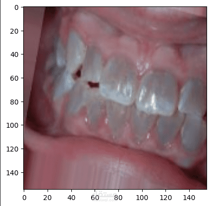 Oral Diseases Prediction