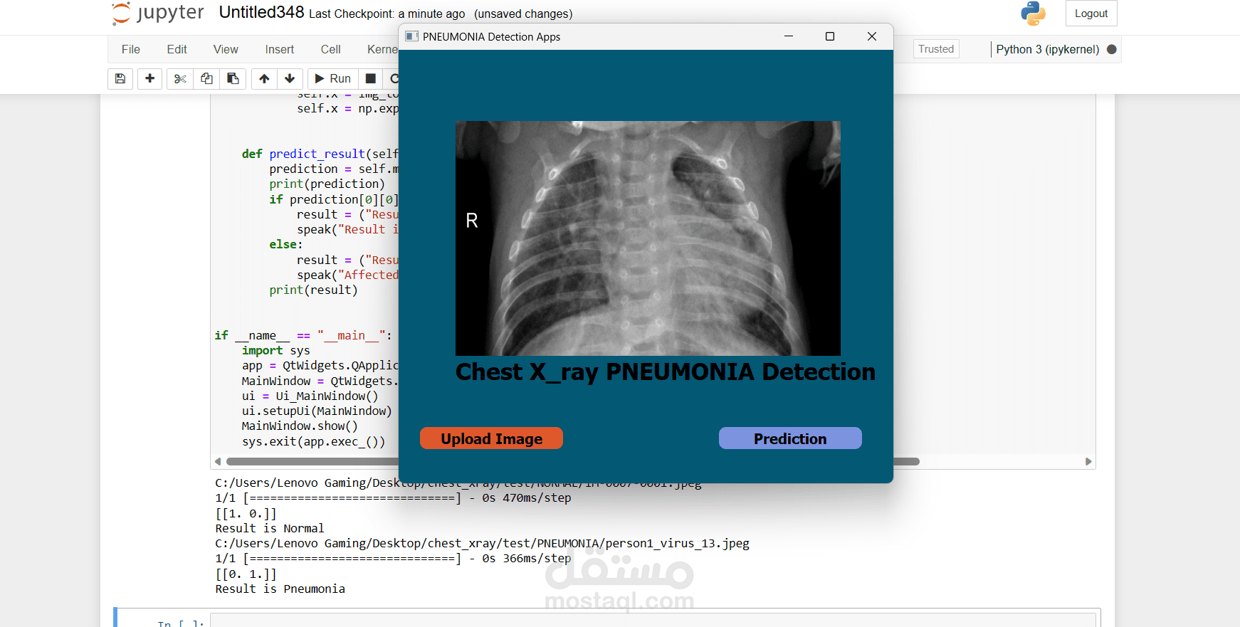 Smart System based on Deep Learning for Pneumonia Infection Detection,