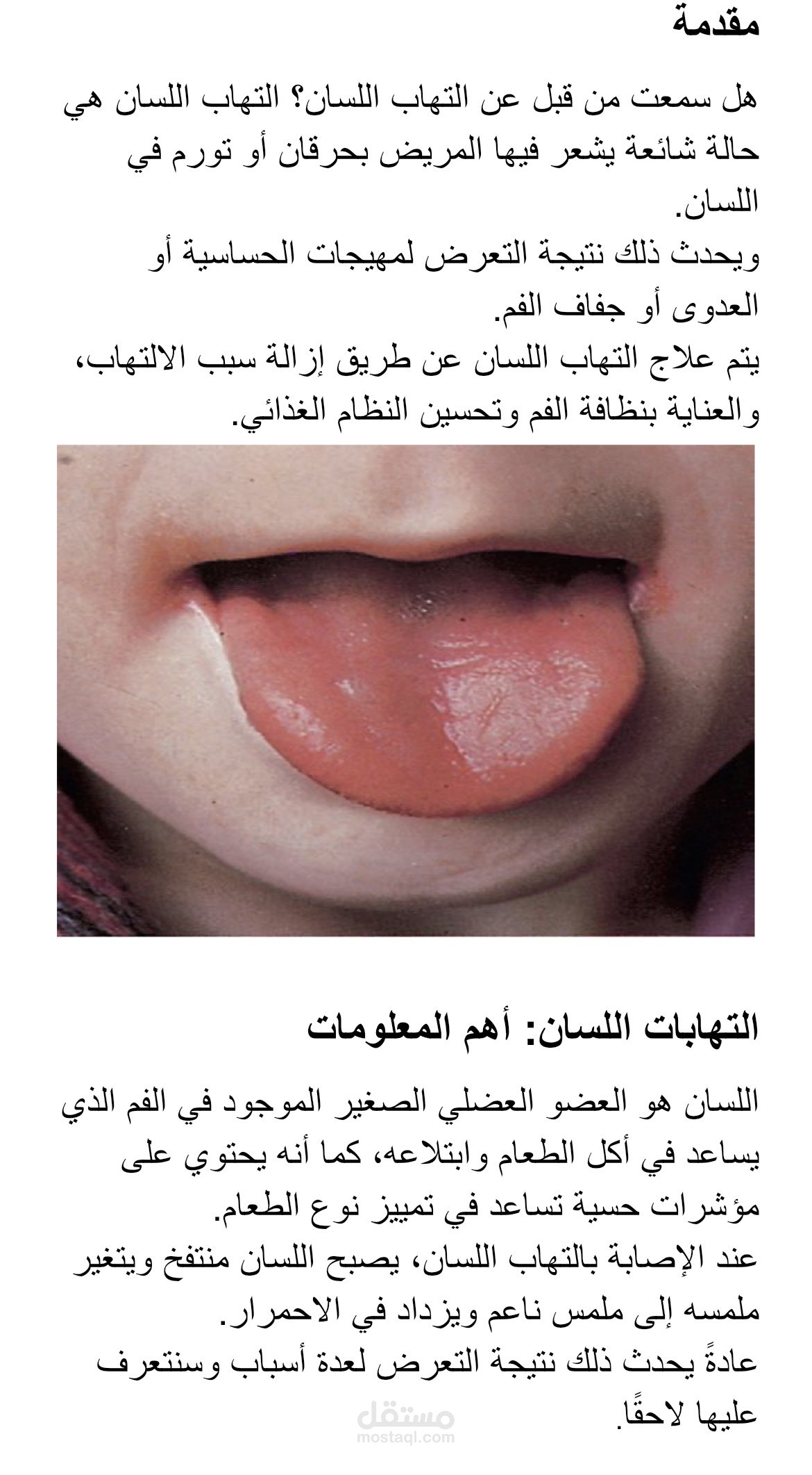 التهاب اللسان