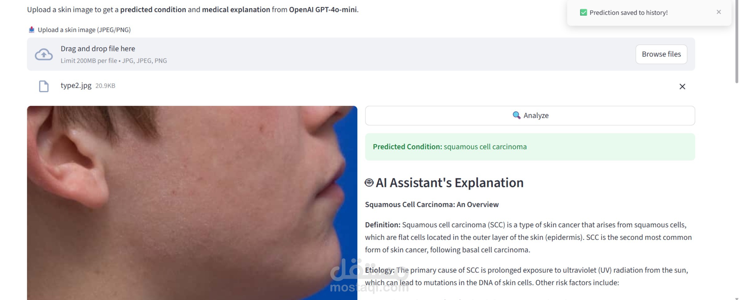 تحليل وتشخيص أمراض الجلد باستخدام الذكاء الاصطناعي (AI Skin Disease Detection)