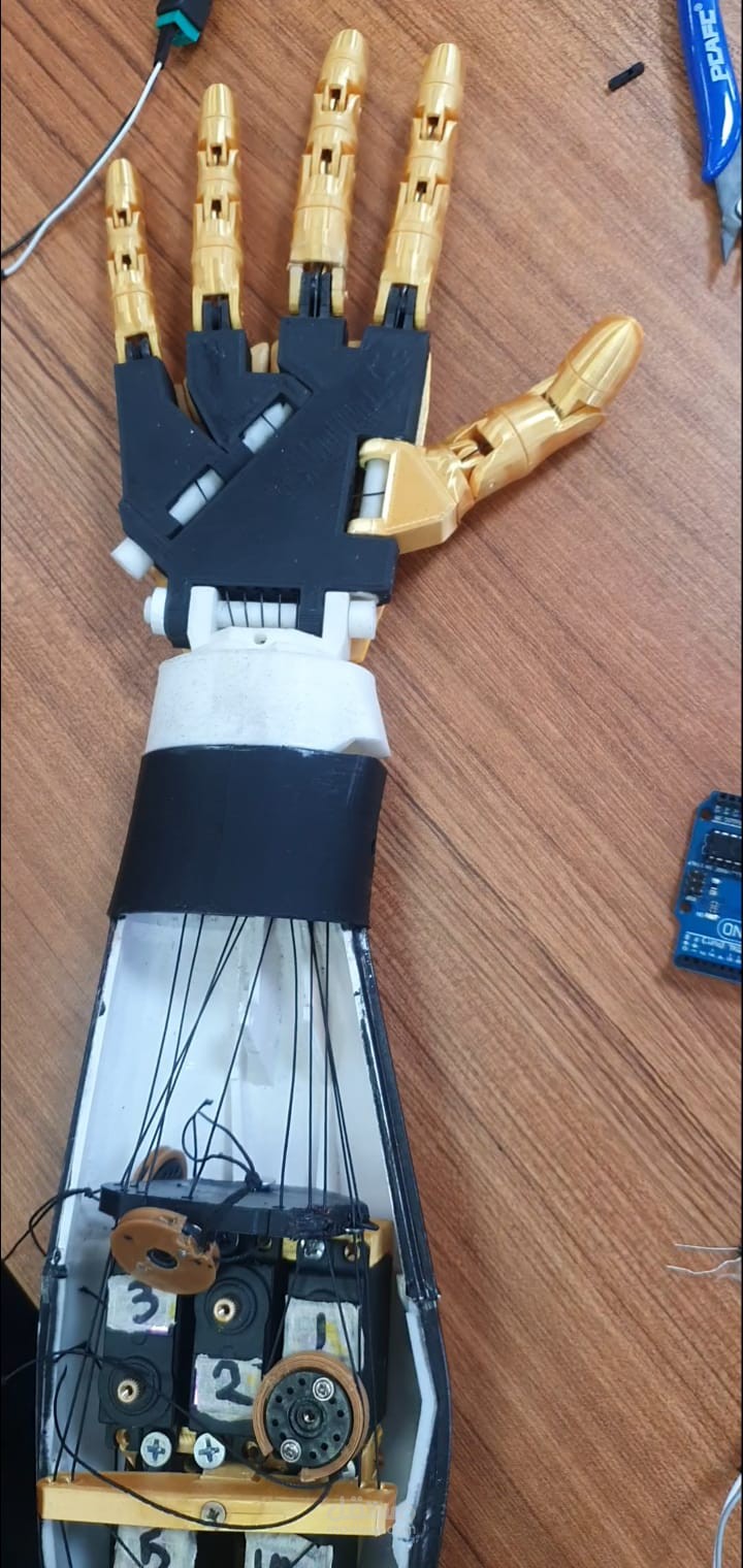 Prosthetic Hand with Wireless Control