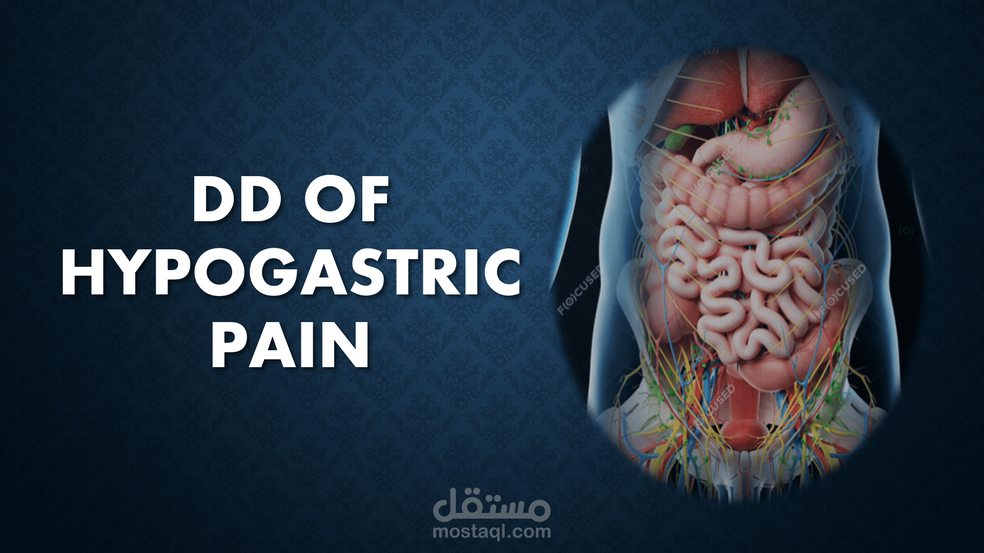 Differential diagnosis of Hypogastric pain