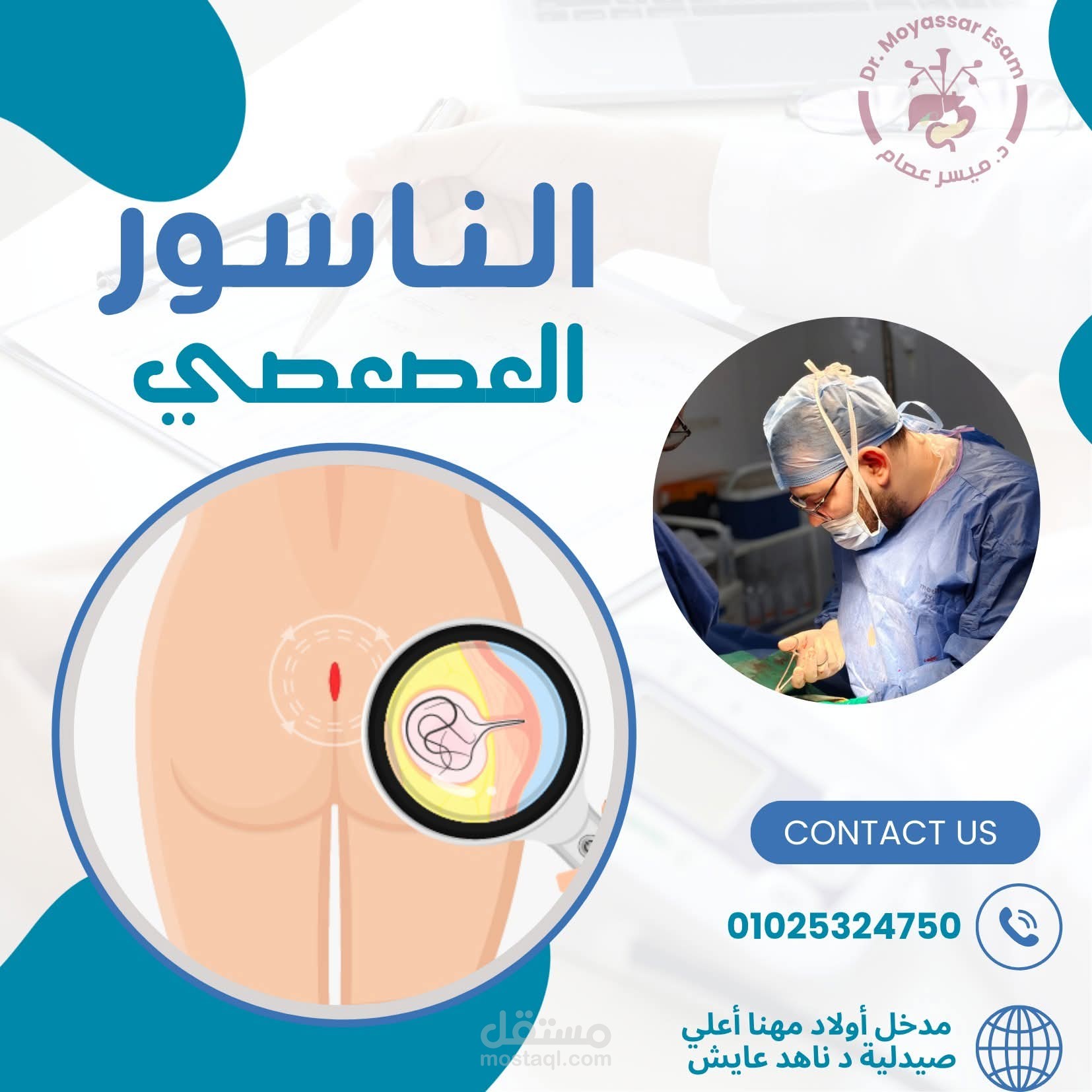 الناسور العصعصى