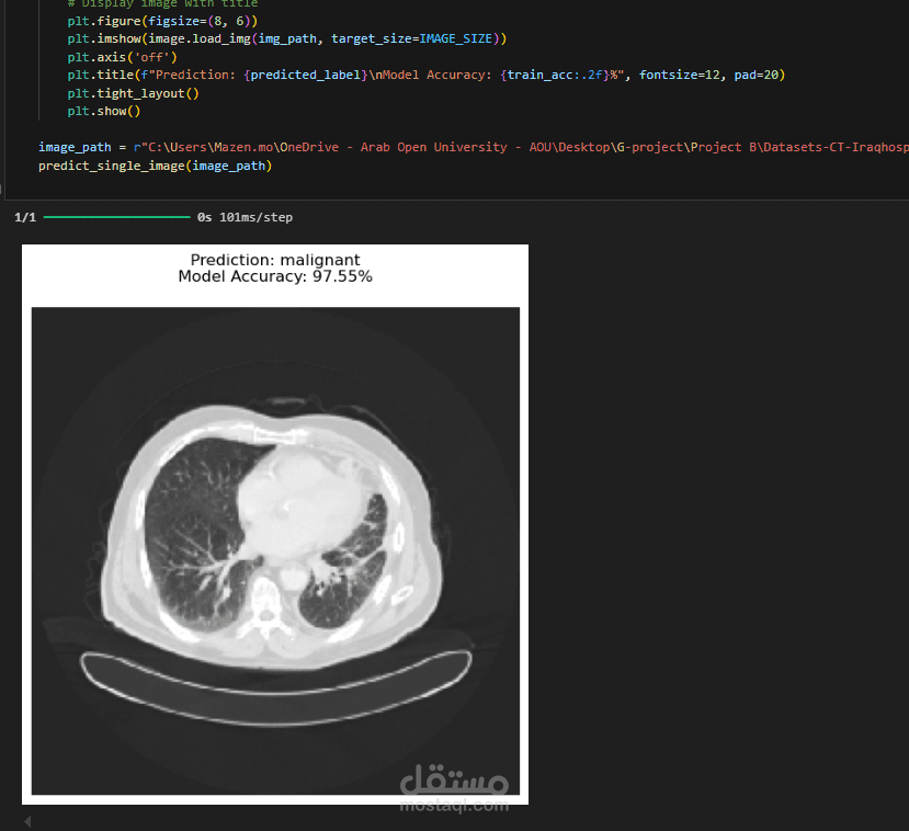 Hybrid Machine Learning System for Early Lung Cancer Detection