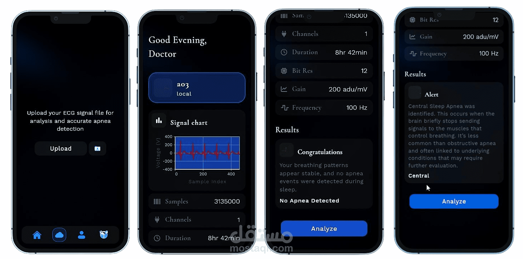 Sleep Apnea Detection using ECG Signal (Graduation project)