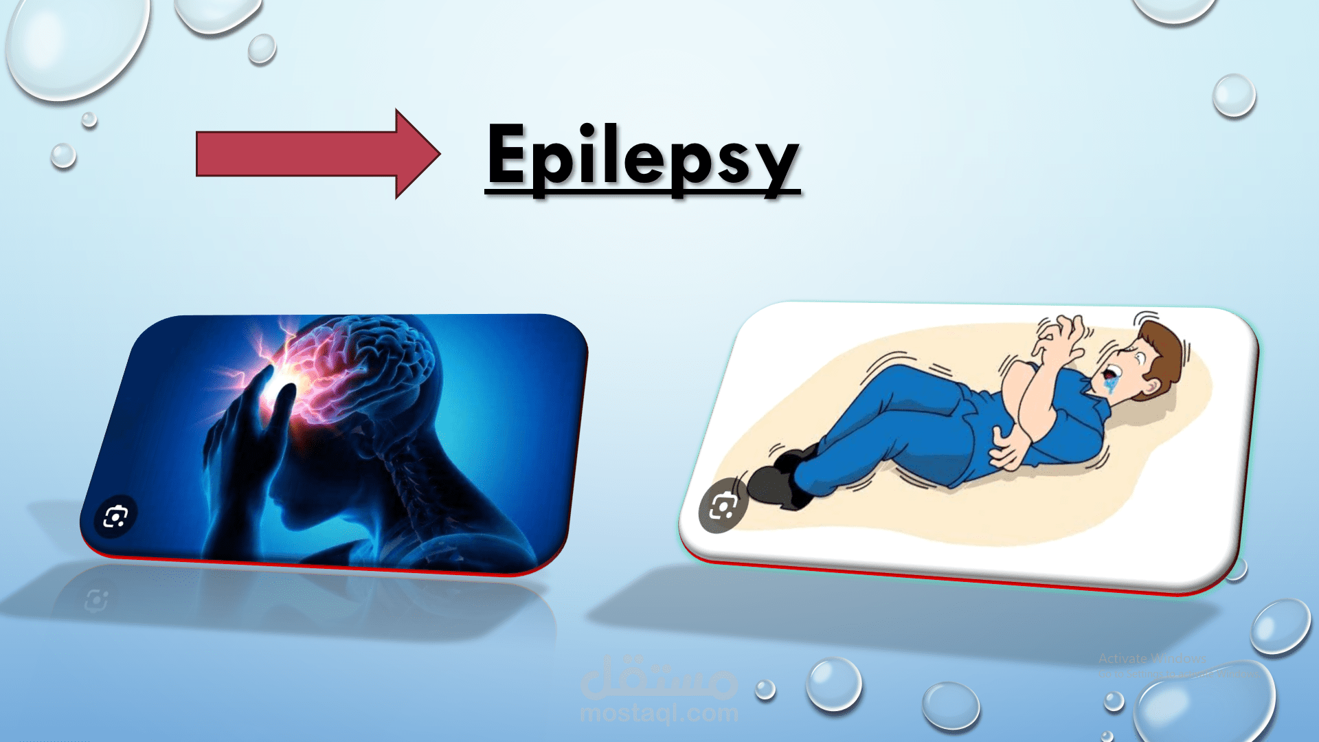 تصميم عرض تقديمي طبي احترافي عن مرض الصرع