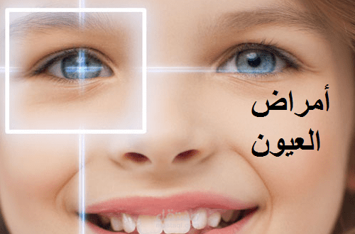 من أعمالي .. أمراض العيون المنتشرة.