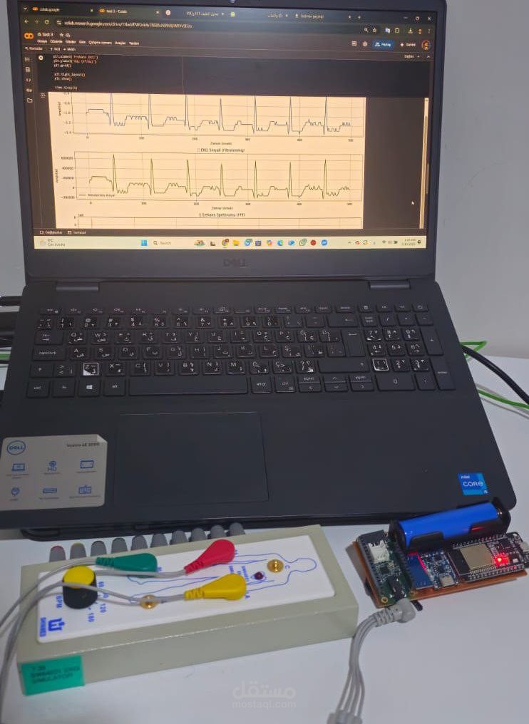 مشروع قياس ال ECGو تحليله عن طريق الذكاء الاصطناعي