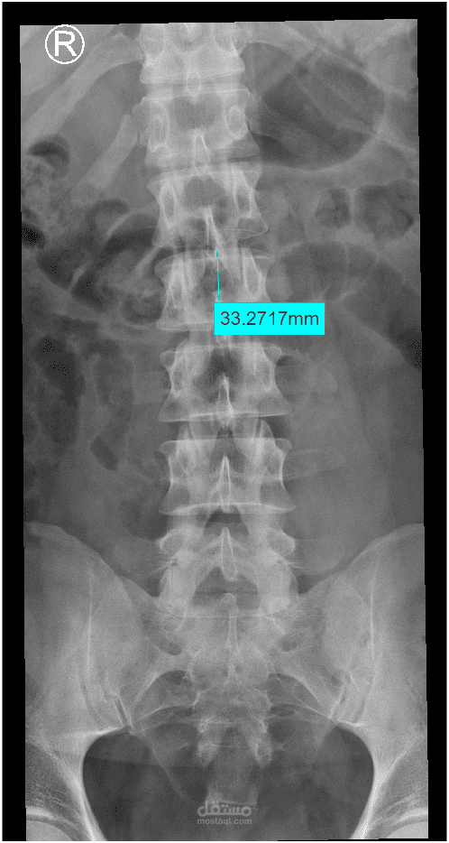 معالجة الصور الطبية عن طريق برنامج matlab