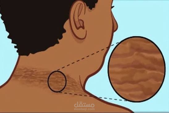 لجسمك كلام… مقاومة الإنسولين بلغة بسيطة