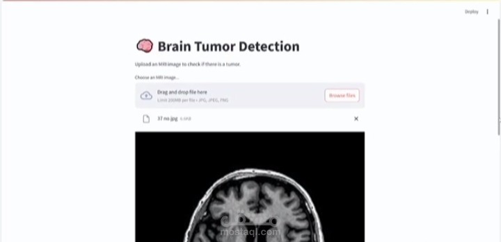Brain tumor classification