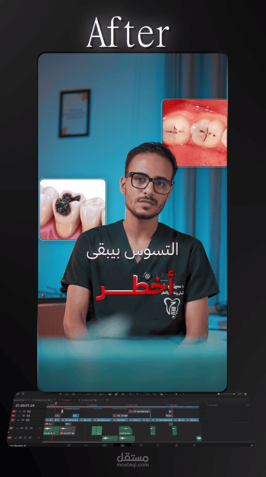 مونتاج الريلز  (المحتوي الطبي)