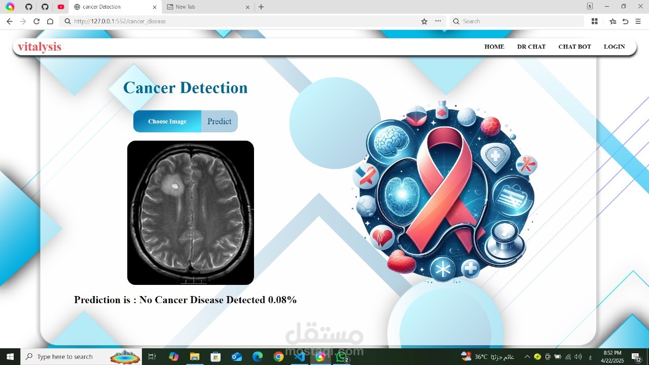 تصنيف أورام المخ