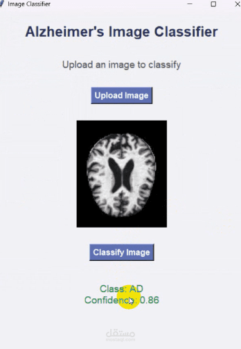 Alzheimer's Image Classifier