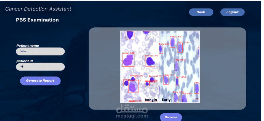 مساعد الكشف عن السرطان