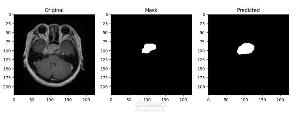 Brain Tumor Segmentation using U-Net