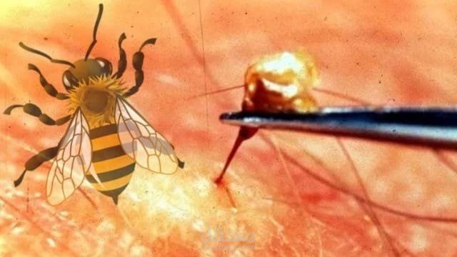مقال عن العلاج بسم النحل