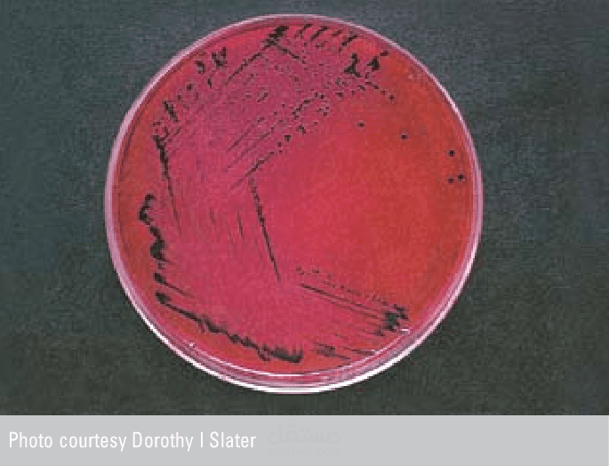 Salmonella enteritidis