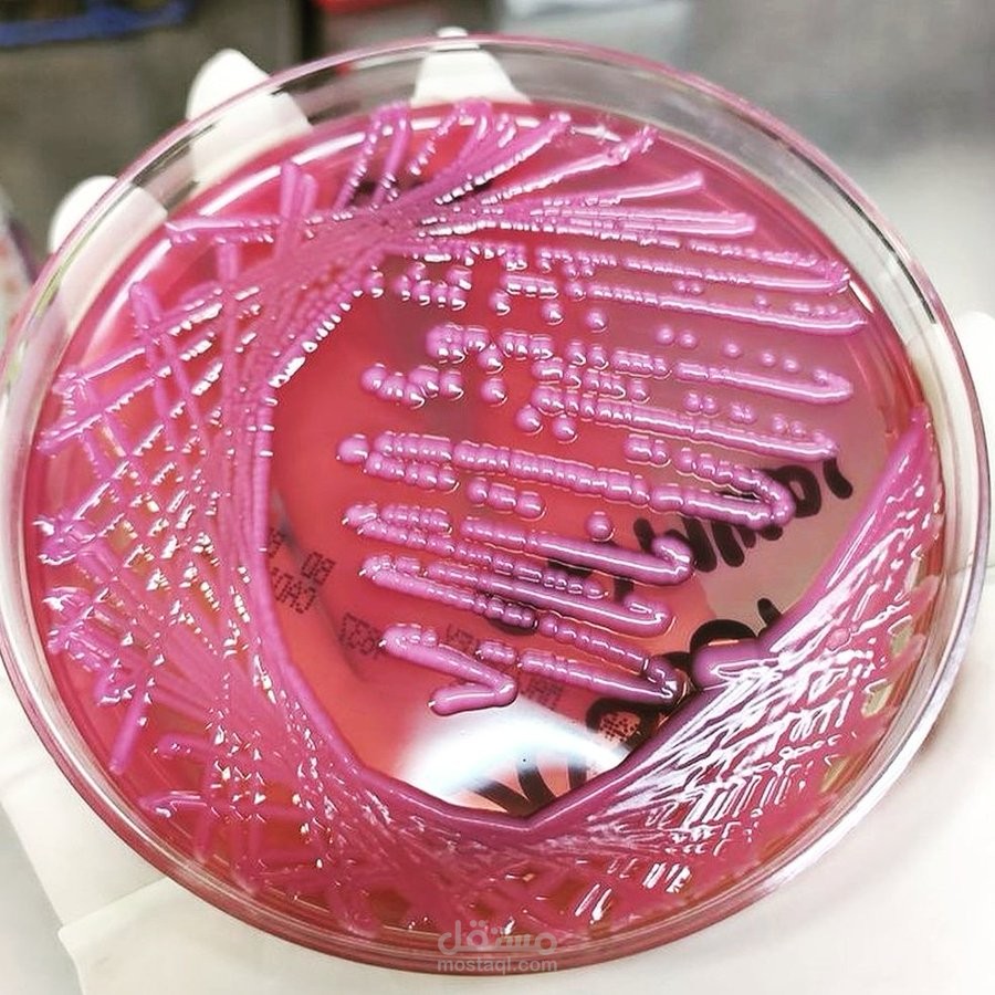 Klebsiella pneumoniae