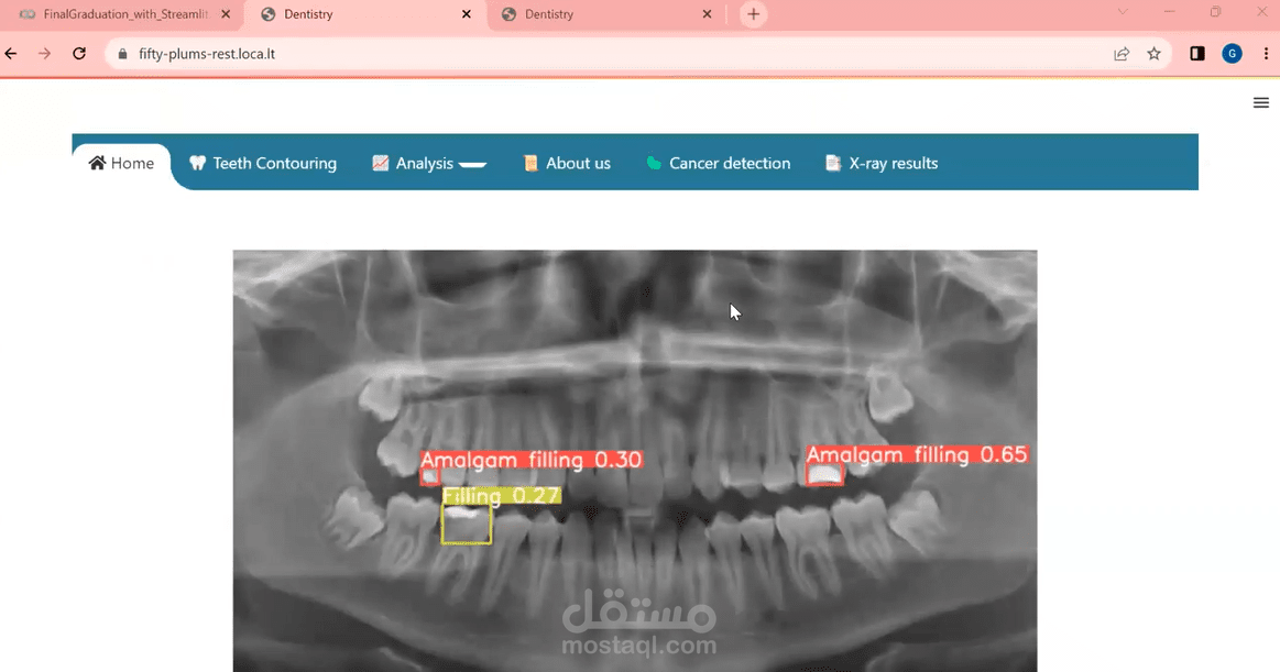 Graduation Project Deep Learning Algorithms for Dental X-rays