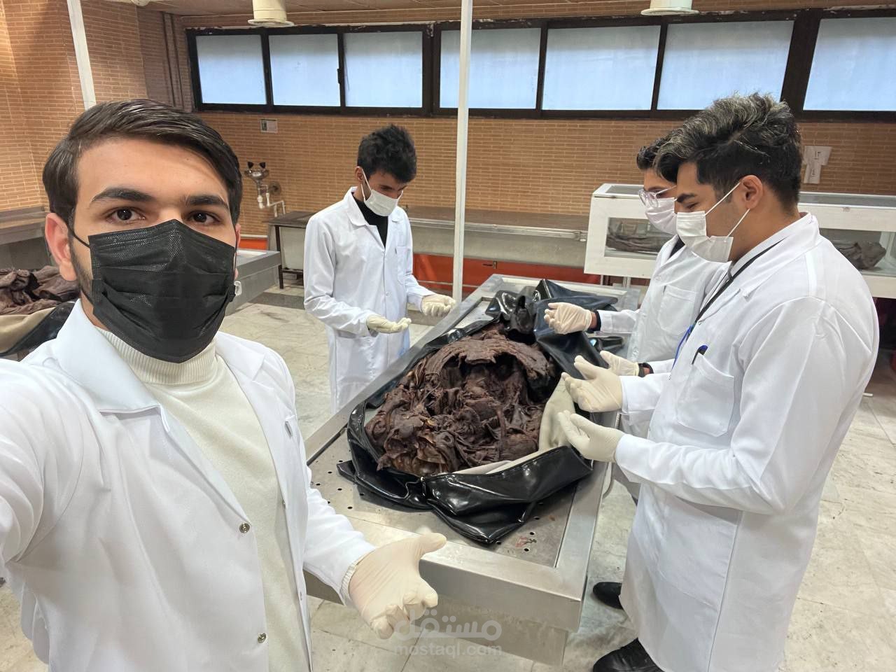 محاضرة طبية أكاديمية: تشريح المثلث تحت القذالي (Suboccipital Triangle).