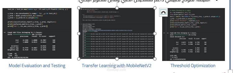 بناء نموذج ذكي لاكتشاف سرطان الجلد باستخدام CNN