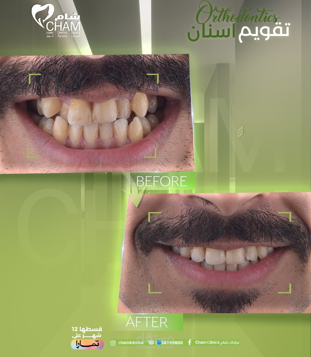صناعة ريلز احترافي لعيادات شام