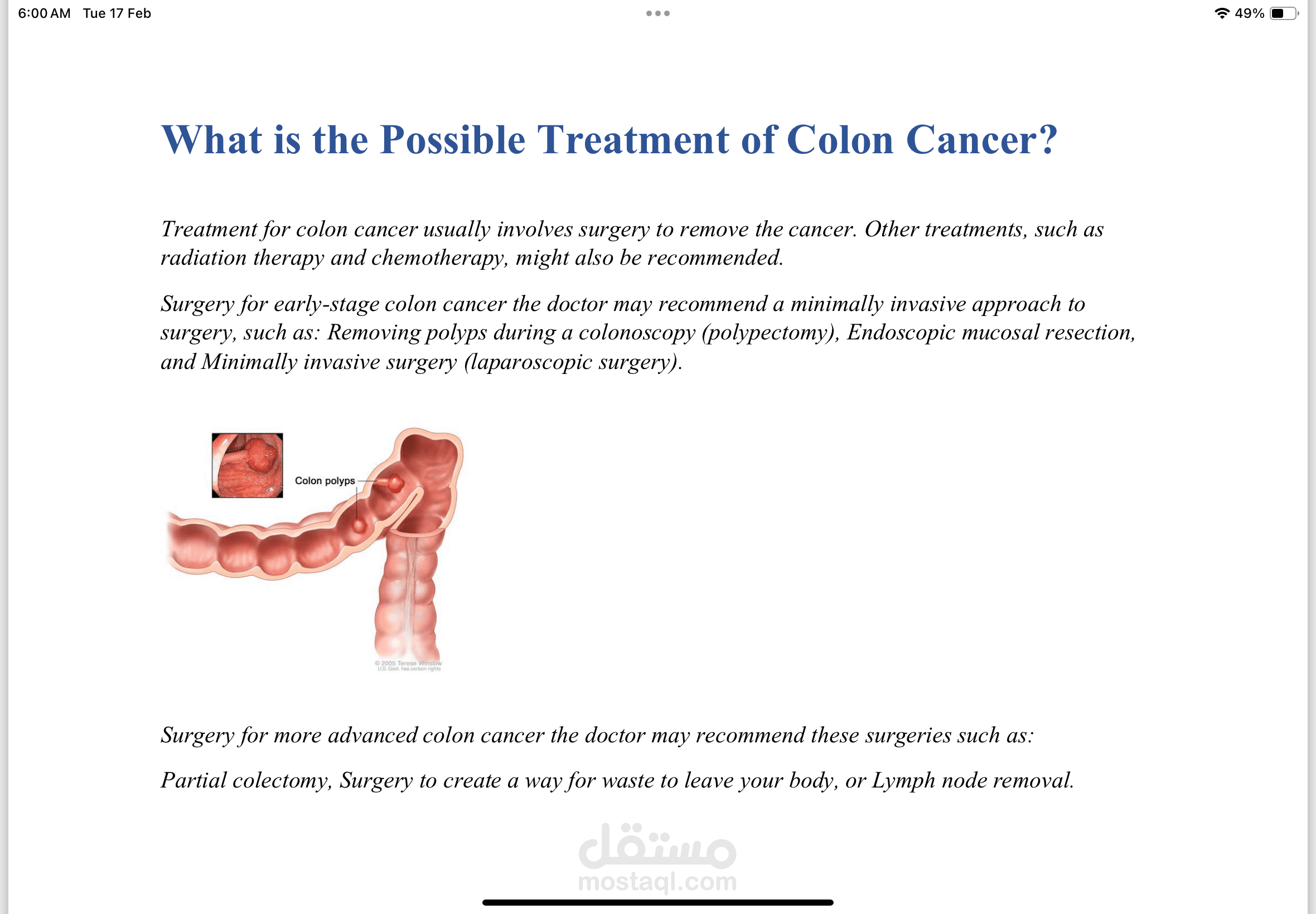 Colon Cancer Introduction Research