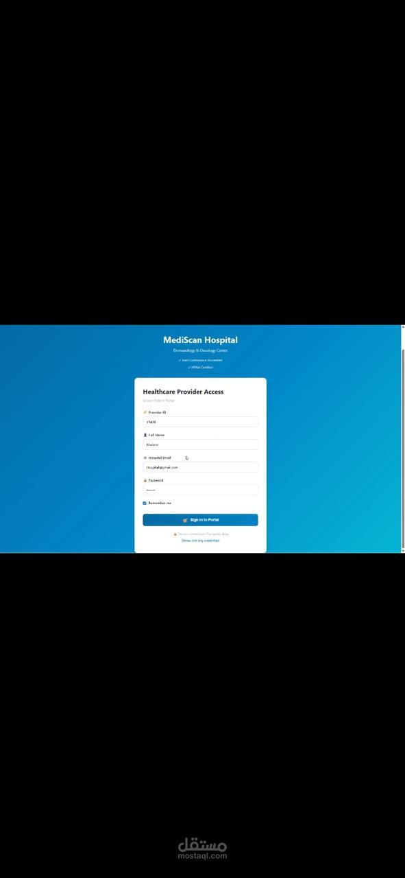 Melanoma detection model
