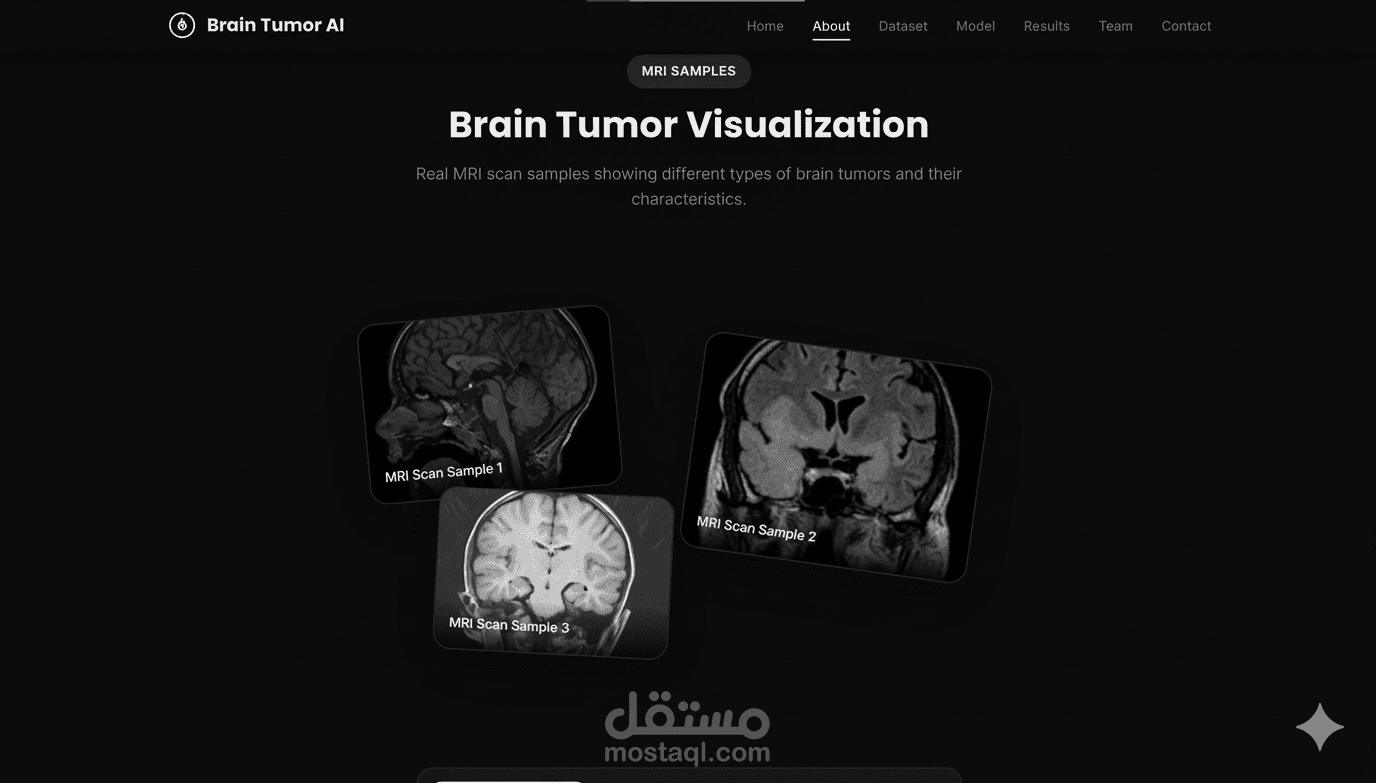Brain tumor detection model