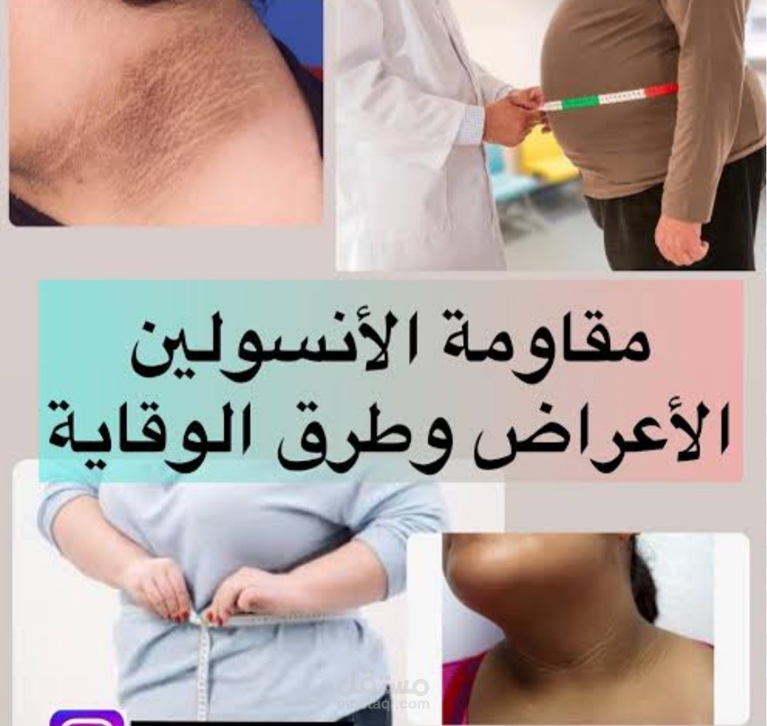 مقال طبي احترافي: مقاومة الإنسولين – الأسباب، الأعراض، والتشخيص والعلاج
