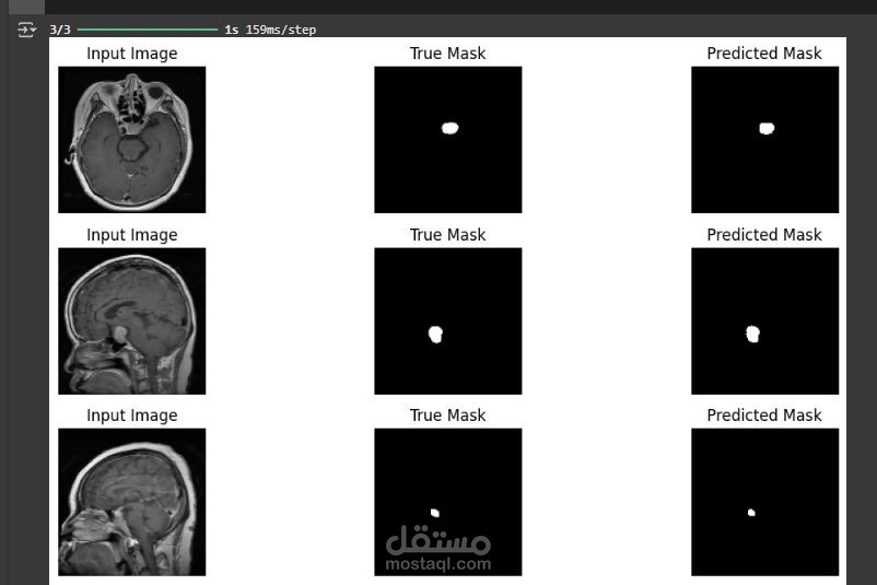 Brain Tumor Segmentation