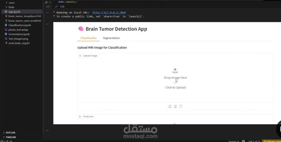 نظام ذكي للكشف عن أورام الدماغ وتجزئتها باستخدام التعلم العميق