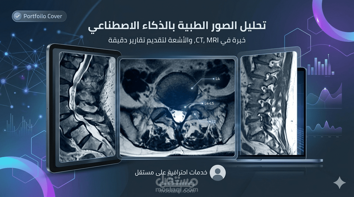 تصميم نماذج ذكاء اصطناعي لتشخيص حالات العمود الفقري من صور الرنين المغناطيسي