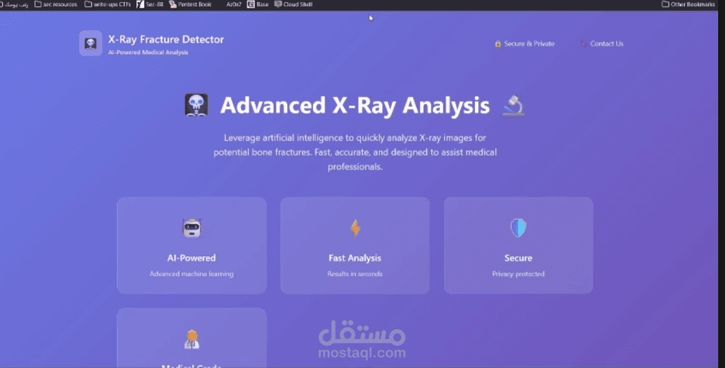 X_Ray bone fracture detector by deep learning and computer vision
