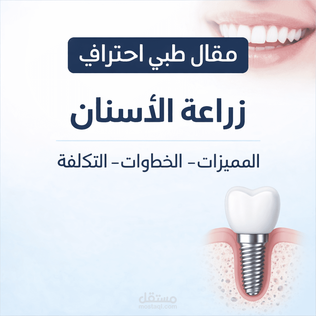 كتابة مقال طبي احترافي عن زراعة الأسنان