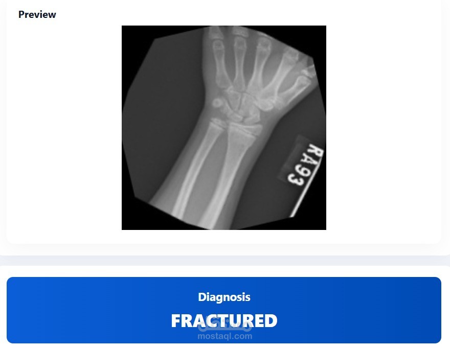 نظام توقع وتحليل بيانات باستخدام تعلم machine learning & deep learning
