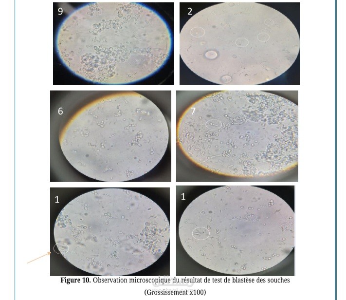 Identification des espèces de Candida isolées de la mammite chez les vaches laitières