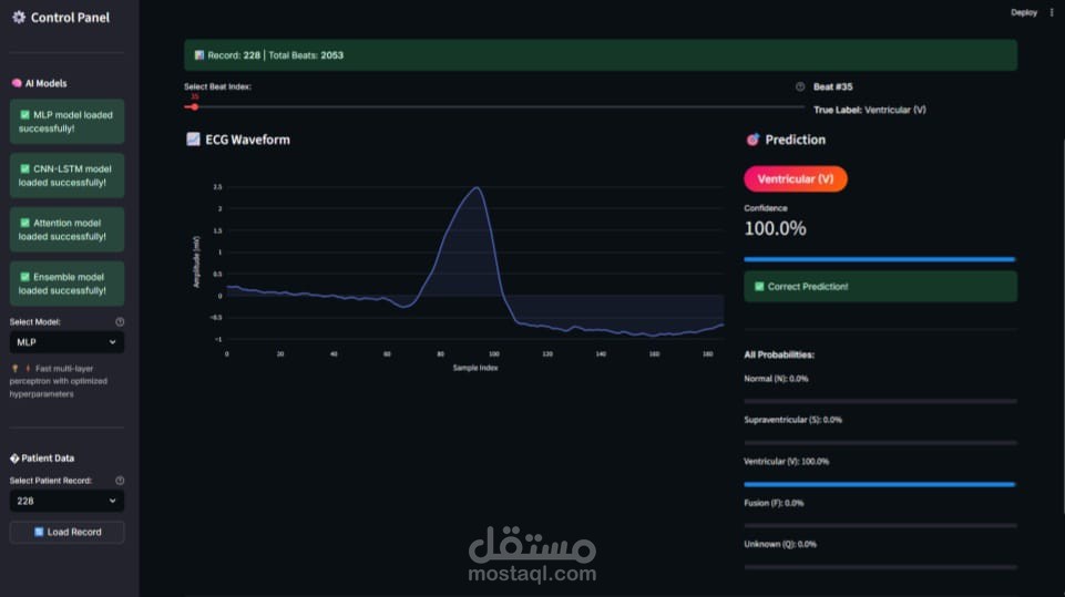 Automated ECG Arrhytmia Detection (Neural Network Classification Project)